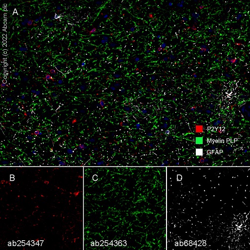 Multiplex immunohistochemistry - Anti-GFAP antibody [EPR1034Y] - Astrocyte Marker (ab68428), expandable thumbnail