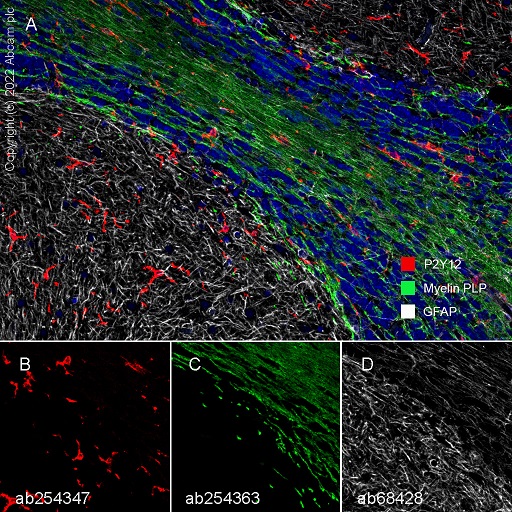 Multiplex immunohistochemistry - Anti-GFAP antibody [EPR1034Y] - Astrocyte Marker (ab68428), expandable thumbnail