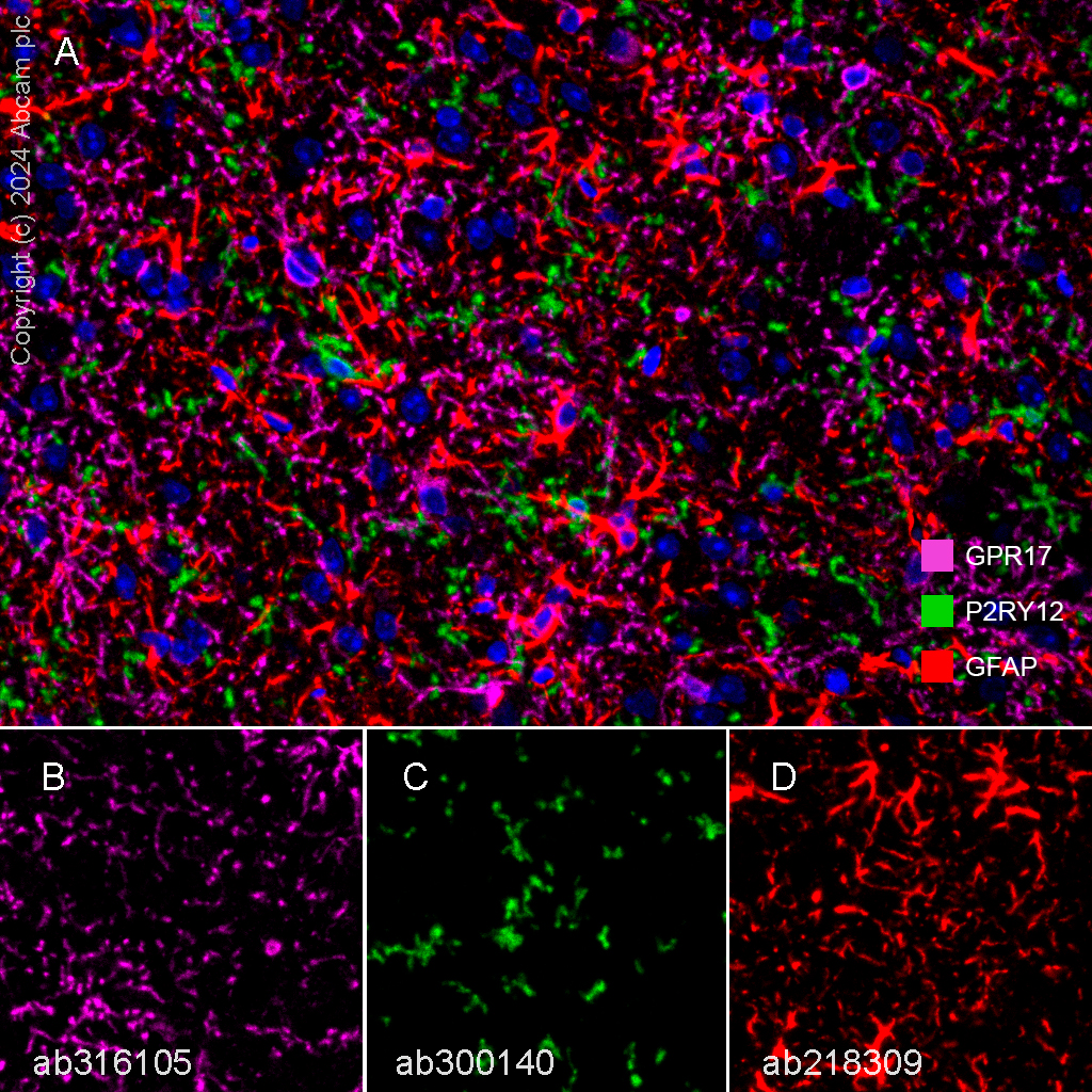 Multiplex immunohistochemistry - Anti-GFAP antibody [EPR1034Y] - Astrocyte Marker (ab68428), expandable thumbnail