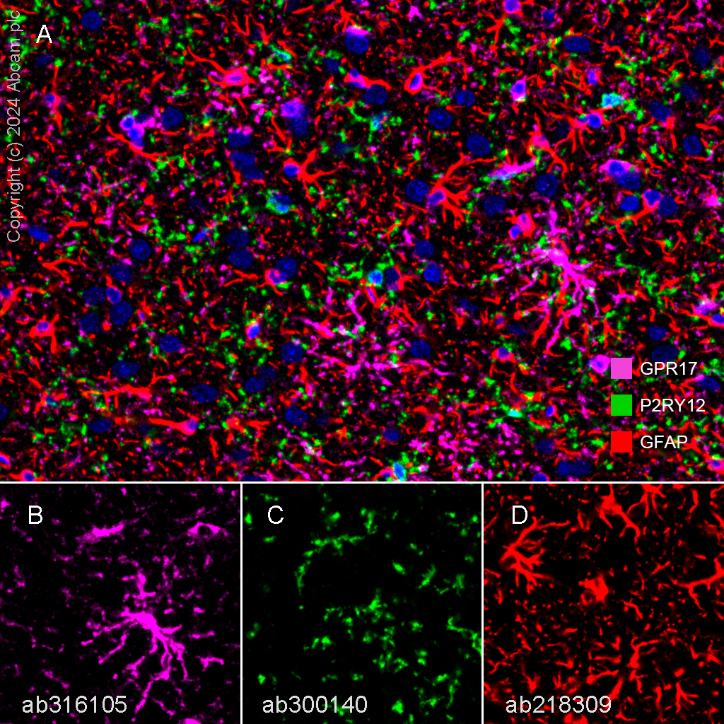 Multiplex immunohistochemistry - Anti-GFAP antibody [EPR1034Y] - Astrocyte Marker (ab68428), expandable thumbnail