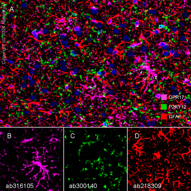 Multiplex immunohistochemistry - Anti-GFAP antibody [EPR1034Y] - Astrocyte Marker (AB68428)
