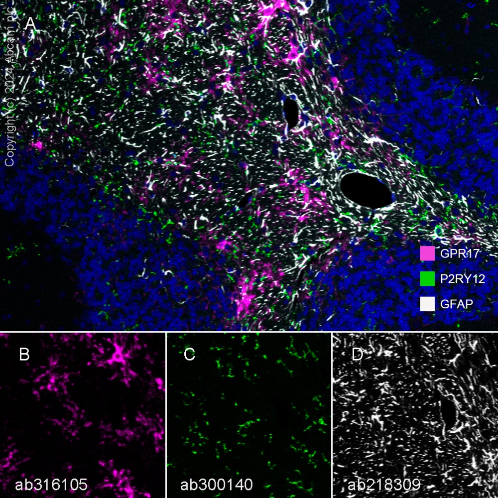 Multiplex immunohistochemistry - Anti-GFAP antibody [EPR1034Y] - Astrocyte Marker (ab68428), expandable thumbnail