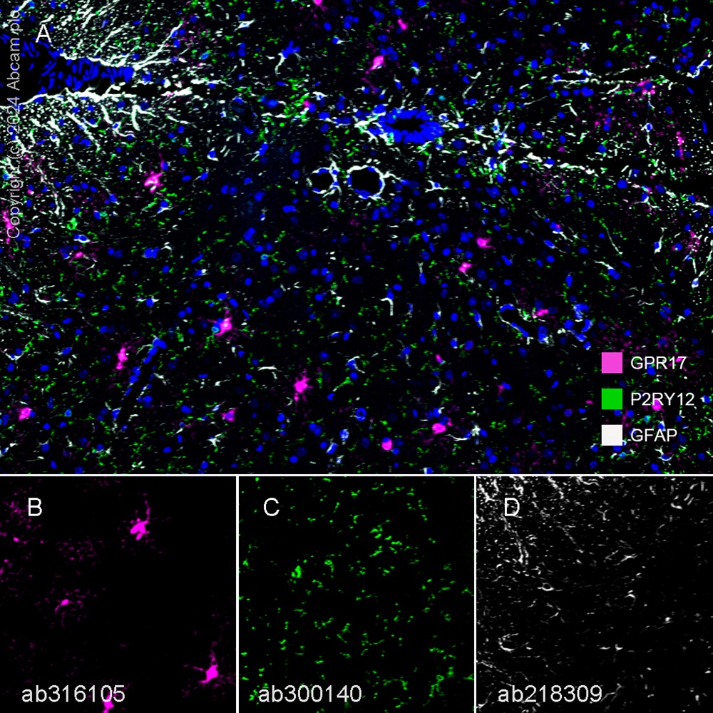 Multiplex immunohistochemistry - Anti-GFAP antibody [EPR1034Y] - Astrocyte Marker (ab68428), expandable thumbnail