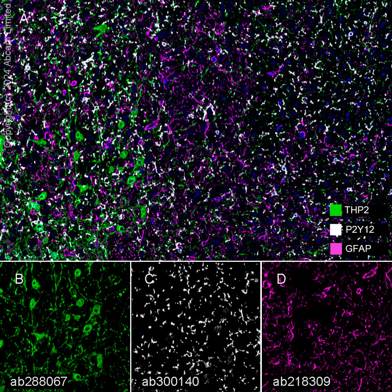 Multiplex immunohistochemistry - Anti-GFAP antibody [EPR1034Y] - Astrocyte Marker (AB68428)