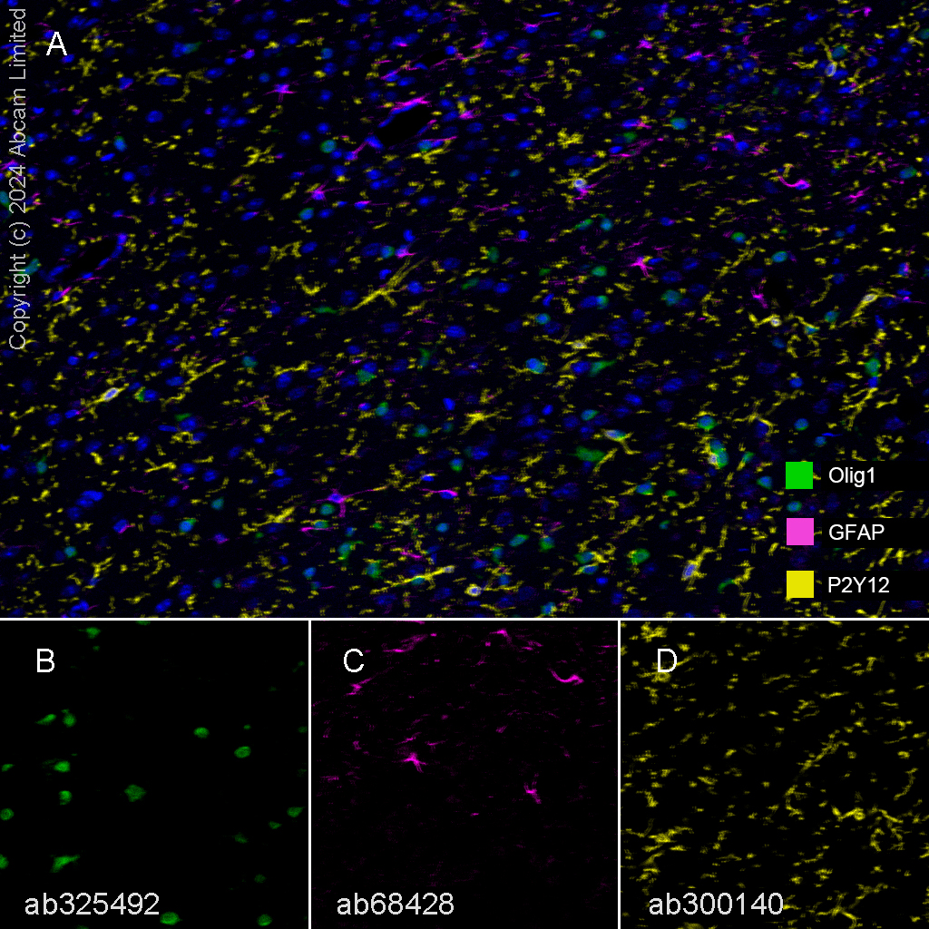Anti-GFAP antibody [EPR1034Y] 20 ul size (ab68428) | Abcam