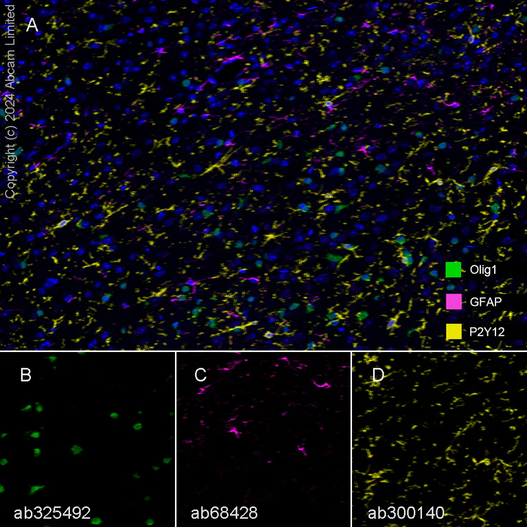 Multiplex immunohistochemistry - Anti-GFAP antibody [EPR1034Y] - Astrocyte Marker (AB68428)