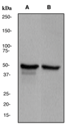 Western blot - Anti-GFAP antibody [EPR1034Y] - Astrocyte Marker (ab68428), expandable thumbnail