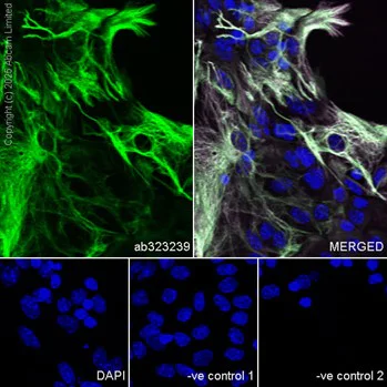 Immunocytochemistry/ Immunofluorescence - Anti-GFAP antibody [EPR1034Y] - Astrocyte marker - Chicken IgY (Chimeric) (AB323239)