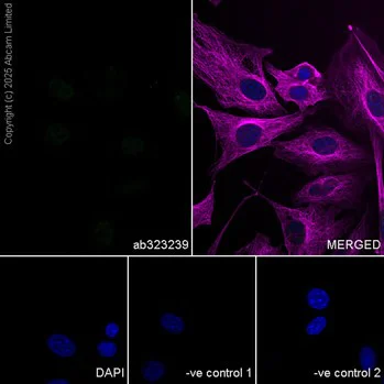 Immunocytochemistry/ Immunofluorescence - Anti-GFAP antibody [EPR1034Y] - Astrocyte marker - Chicken IgY (Chimeric) (AB323239)
