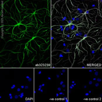 Immunocytochemistry/ Immunofluorescence - Anti-GFAP antibody [EPR1034Y] - Astrocyte marker - Chicken IgY (Chimeric) (AB323239)