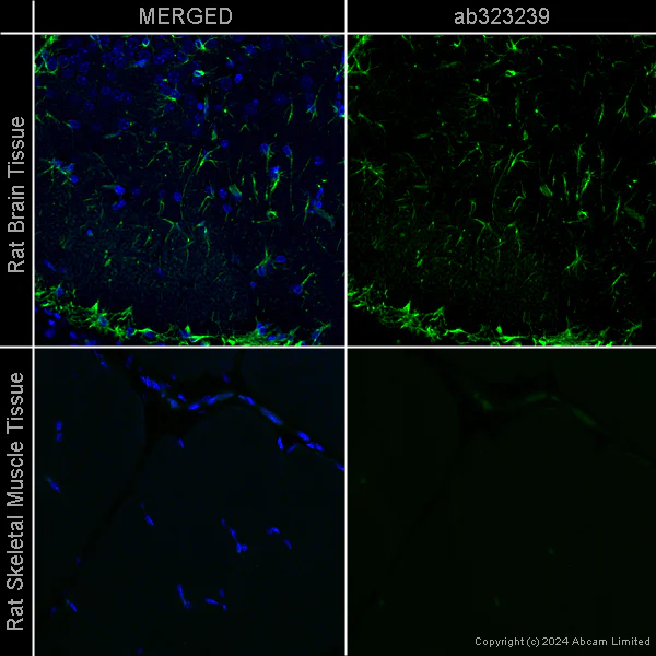 Immunohistochemistry (Formalin/PFA-fixed paraffin-embedded sections) - Anti-GFAP antibody [EPR1034Y] - Astrocyte marker - Chicken IgY (Chimeric) (AB323239)