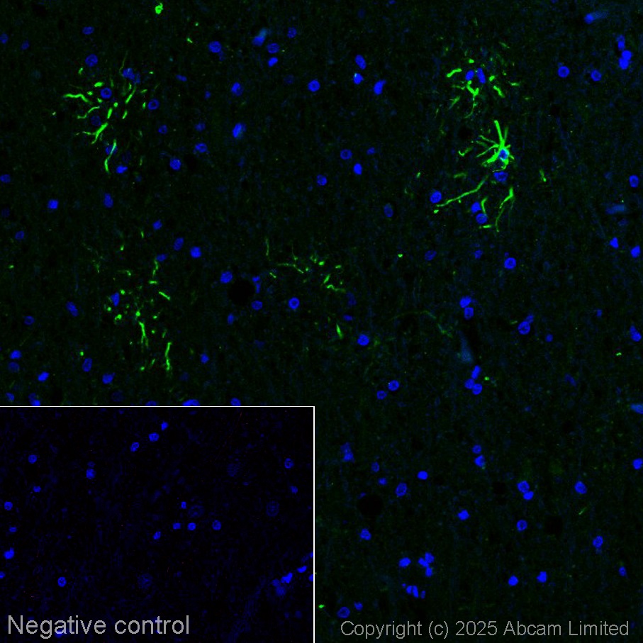Anti-GFAP antibody [EPR1034Y] - Astrocyte marker - Chicken IgY