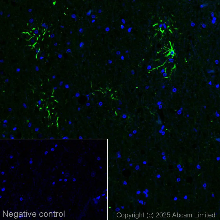 Immunohistochemistry (Formalin/PFA-fixed paraffin-embedded sections) - Anti-GFAP antibody [EPR1034Y] - Astrocyte marker - Chicken IgY (Chimeric) (AB323239)