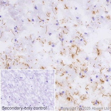 Anti-GFAP antibody [EPR1034Y] - Astrocyte marker - Chicken IgY
