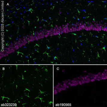 Immunohistochemistry (PFA perfusion fixed frozen sections) - Anti-GFAP antibody [EPR1034Y] - Astrocyte marker - Chicken IgY (Chimeric) (AB323239)