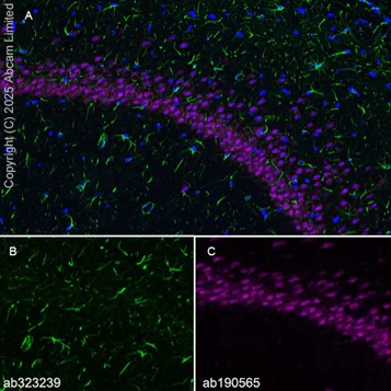 Immunohistochemistry (PFA perfusion fixed frozen sections) - Anti-GFAP antibody [EPR1034Y] - Astrocyte marker - Chicken IgY (Chimeric) (AB323239)