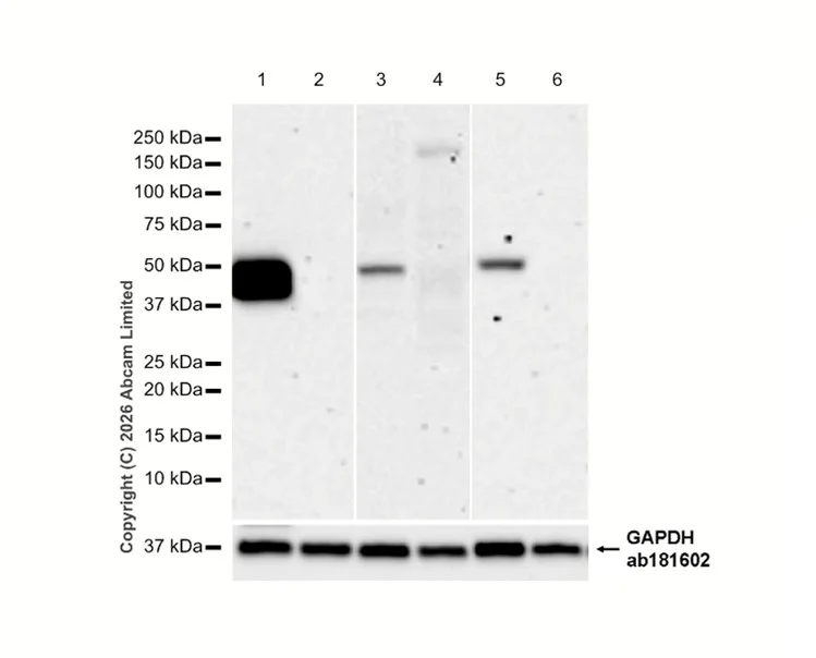 Western blot - Anti-GFAP antibody [EPR1034Y] - Astrocyte marker - Chicken IgY (Chimeric) (AB323239)