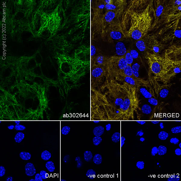 Immunocytochemistry/ Immunofluorescence - Anti-GFAP antibody [EPR1034Y] - Astrocyte marker - Goat IgG (Chimeric) (AB302644)