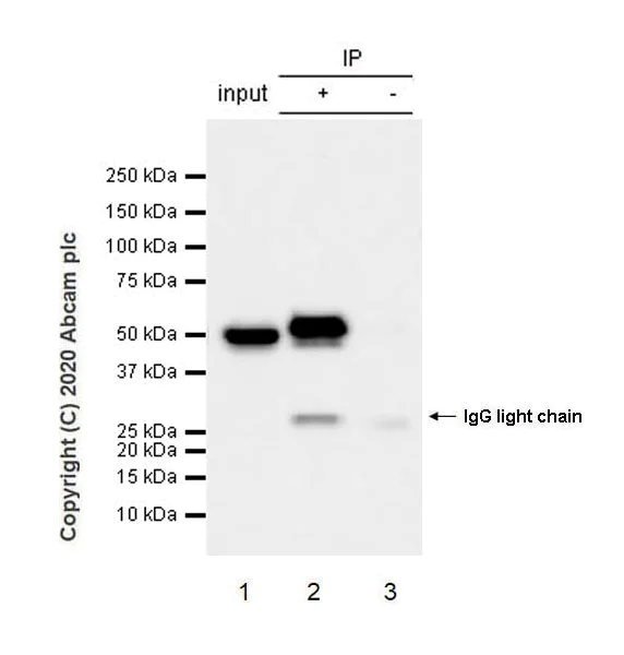 Immunoprecipitation - Anti-GFAP antibody [EPR1034Y] - Astrocyte marker - Mouse IgG2a (Chimeric) (AB279290)