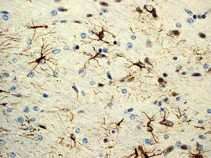 Immunohistochemistry (Formalin/PFA-fixed paraffin-embedded sections) - Anti-GFAP antibody [EPR1034Y] - BSA and Azide free (AB218309)