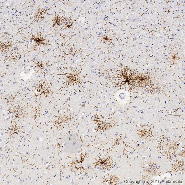 Immunohistochemistry (Formalin/PFA-fixed paraffin-embedded sections) - Anti-GFAP antibody [EPR1034Y] - BSA and Azide free (AB218309)