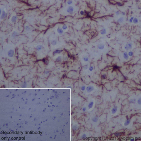 Immunohistochemistry (Formalin/PFA-fixed paraffin-embedded sections) - Anti-GFAP antibody [EPR1034Y] - BSA and Azide free (AB218309)