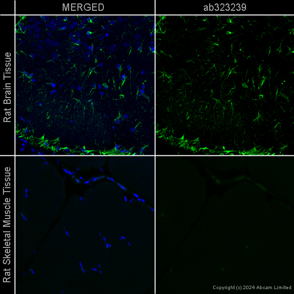 Immunohistochemistry (Formalin/PFA-fixed paraffin-embedded sections) - Anti-GFAP antibody [EPR1034Y] – Chicken IgY (Chimeric) (AB323239), expandable thumbnail