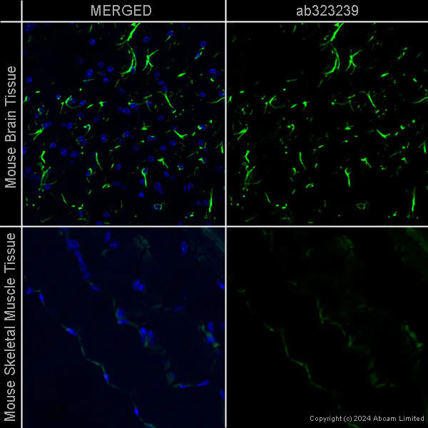 Immunohistochemistry (Formalin/PFA-fixed paraffin-embedded sections) - Anti-GFAP antibody [EPR1034Y] – Chicken IgY (Chimeric) – BSA and Azide Free (AB323248)