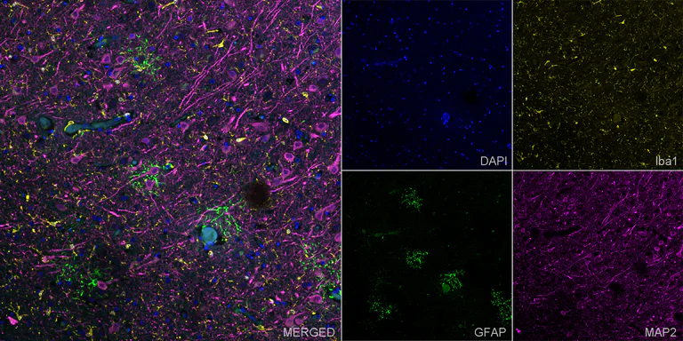 Immunohistochemistry (Formalin/PFA-fixed paraffin-embedded sections) - Anti-GFAP antibody [EPR1034Y] – Chicken IgY (Chimeric) – BSA and Azide Free (AB323248)