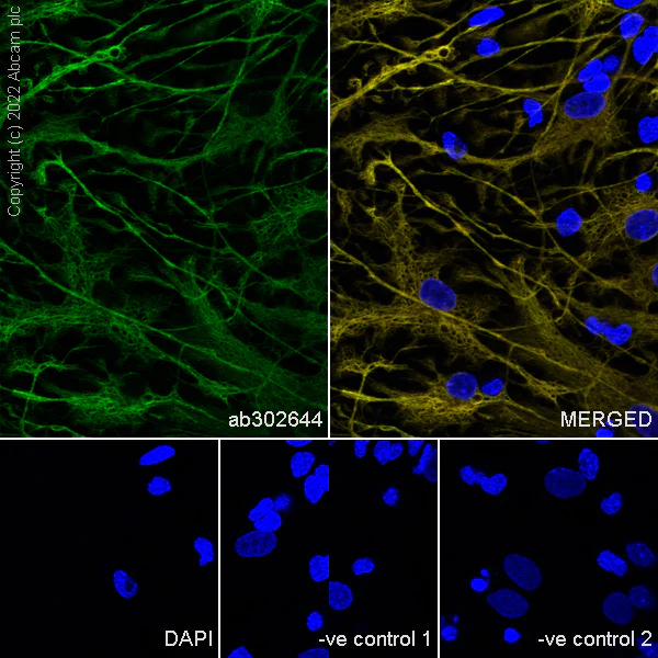 Immunocytochemistry/ Immunofluorescence - Anti-GFAP antibody [EPR1034Y] - Goat IgG (Chimeric) - BSA and Azide free (AB302645)