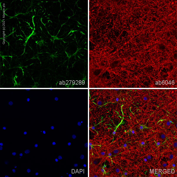 Immunocytochemistry - Anti-GFAP antibody [EPR1034Y] - Mouse IgG1 (Chimeric) (AB279289), expandable thumbnail