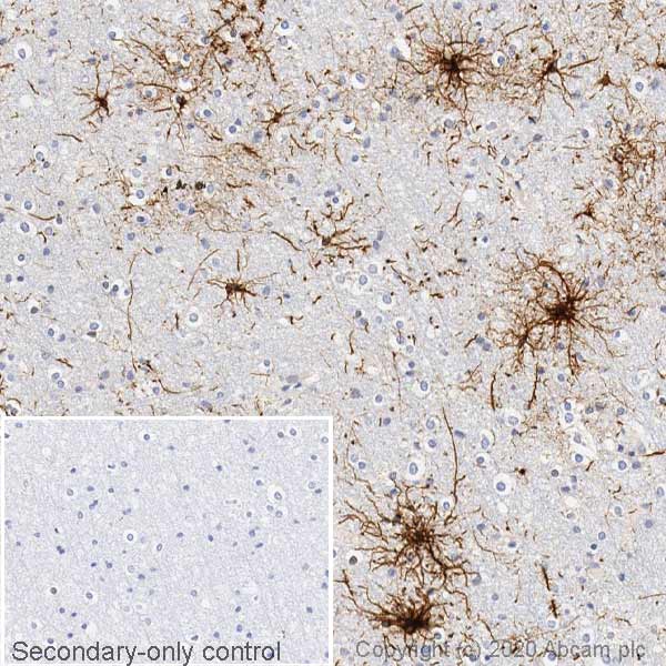 Immunohistochemistry (Formalin/PFA-fixed paraffin-embedded sections) - Anti-GFAP antibody [EPR1034Y] - Mouse IgG1 (Chimeric) (AB279289), expandable thumbnail