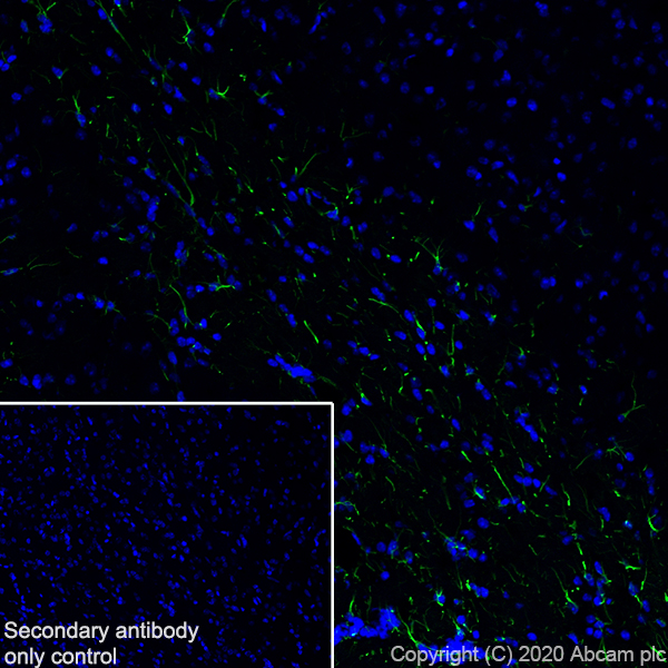 Immunohistochemistry (Frozen sections) - Anti-GFAP antibody [EPR1034Y] - Mouse IgG1 (Chimeric) (AB279289), expandable thumbnail