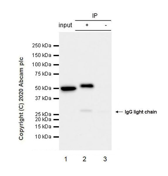 Immunoprecipitation - Anti-GFAP antibody [EPR1034Y] - Mouse IgG1 (Chimeric) (AB279289), expandable thumbnail