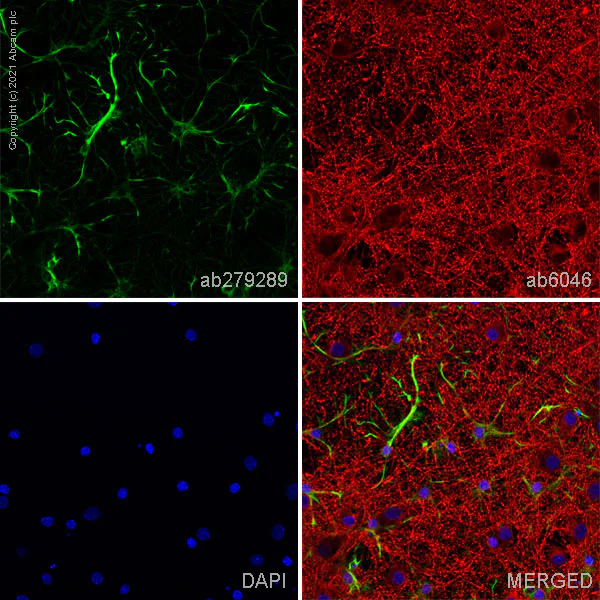 Immunocytochemistry - Anti-GFAP antibody [EPR1034Y] - Mouse IgG1 (Chimeric) - BSA and Azide free (AB279301)