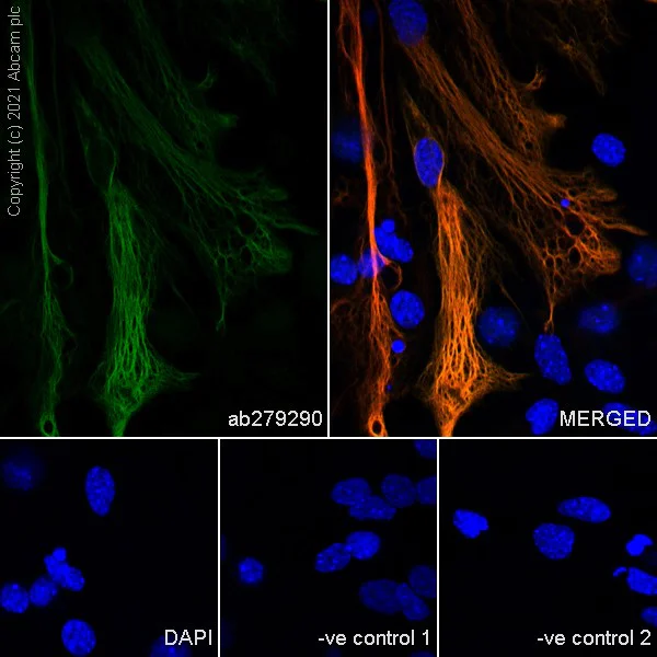 Immunocytochemistry - Anti-GFAP antibody [EPR1034Y] - Mouse IgG2a (Chimeric) - BSA and Azide free (AB279302)
