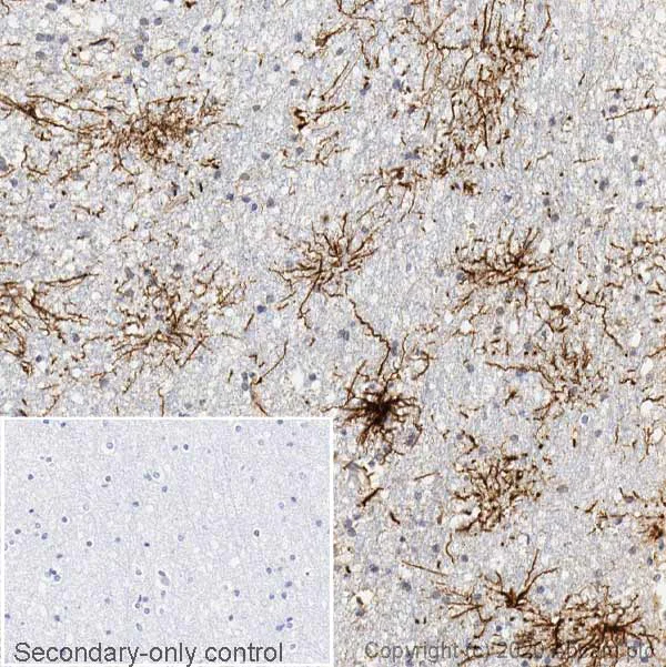 Immunohistochemistry (Formalin/PFA-fixed paraffin-embedded sections) - Anti-GFAP antibody [EPR1034Y] - Mouse IgG2a (Chimeric) - BSA and Azide free (AB279302)