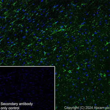 Immunohistochemistry (Frozen sections) - Anti-GFAP antibody [EPR1034Y] - Mouse IgG2a (Chimeric) - BSA and Azide free (AB279302)