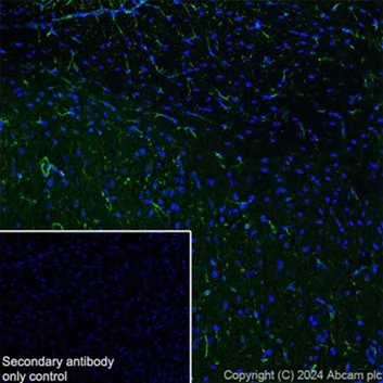 Immunohistochemistry (Frozen sections) - Anti-GFAP antibody [EPR1034Y] - Mouse IgG2a (Chimeric) - BSA and Azide free (AB279302)