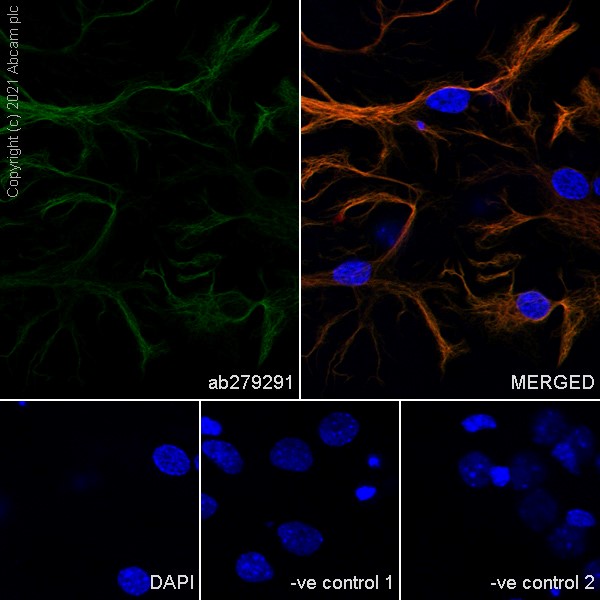 Immunocytochemistry - Anti-GFAP antibody [EPR1034Y] - Rat IgG2a (Chimeric) - BSA and Azide free (AB279303), expandable thumbnail