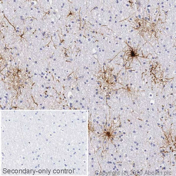 Immunohistochemistry (Formalin/PFA-fixed paraffin-embedded sections) - Anti-GFAP antibody [EPR1034Y] - Rat IgG2a (Chimeric) - BSA and Azide free (AB279303)