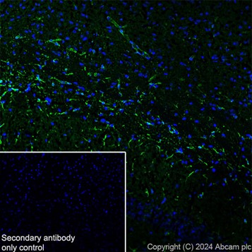 Immunohistochemistry (Frozen sections) - Anti-GFAP antibody [EPR1034Y] - Rat IgG2a (Chimeric) - BSA and Azide free (ab279303), expandable thumbnail
