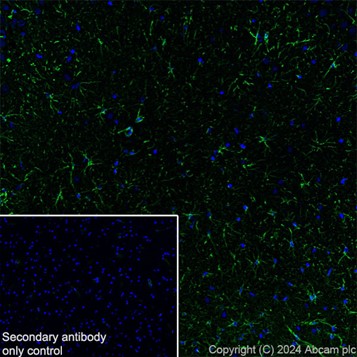 Immunohistochemistry (Frozen sections) - Anti-GFAP antibody [EPR1034Y] - Rat IgG2a (Chimeric) - BSA and Azide free (AB279303), expandable thumbnail