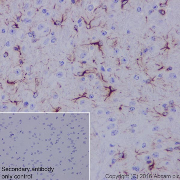 Immunohistochemistry (Formalin/PFA-fixed paraffin-embedded sections) - Anti-GFAP antibody [EPR19996] (ab207165), expandable thumbnail