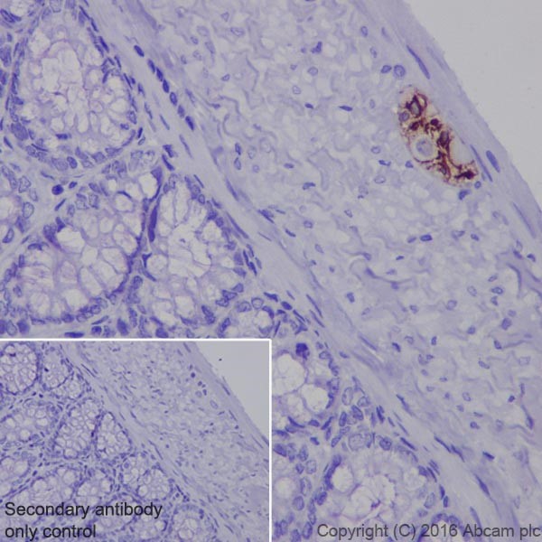 Immunohistochemistry (Formalin/PFA-fixed paraffin-embedded sections) - Anti-GFAP antibody [EPR19996] (ab207165), expandable thumbnail