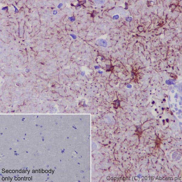 Immunohistochemistry (Formalin/PFA-fixed paraffin-embedded sections) - Anti-GFAP antibody [EPR19996] (AB207165), expandable thumbnail