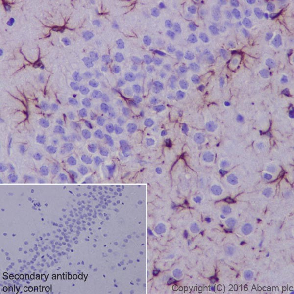 Immunohistochemistry (Formalin/PFA-fixed paraffin-embedded sections) - Anti-GFAP antibody [EPR19996] (ab207165), expandable thumbnail