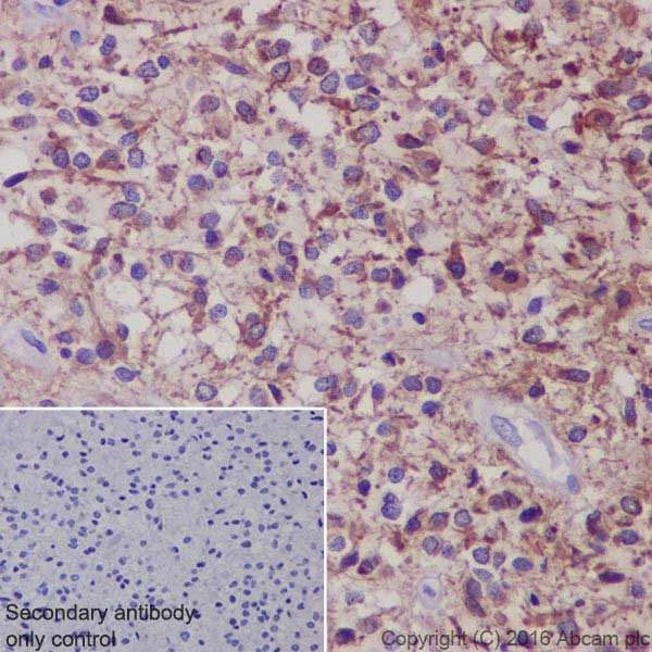 Immunohistochemistry (Formalin/PFA-fixed paraffin-embedded sections) - Anti-GFAP antibody [EPR19996] (ab207165), expandable thumbnail