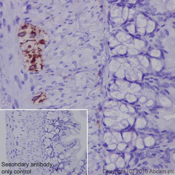 Immunohistochemistry (Formalin/PFA-fixed paraffin-embedded sections) - Anti-GFAP antibody [EPR19996] (ab207165), expandable thumbnail