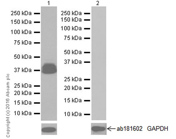 Western blot - Anti-GFAP antibody [EPR19996] - Astrocyte Marker (AB207165), expandable thumbnail